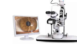 TEQUIPOS OFTALMOLOGIA QUITO